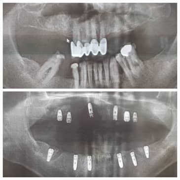 Slider image (8) Prestij Dental Clinic